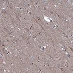 P2X4 Antibody in Immunohistochemistry (Paraffin) (IHC (P))
