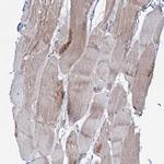 P2X4 Antibody in Immunohistochemistry (Paraffin) (IHC (P))