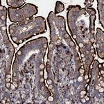 P2X4 Antibody in Immunohistochemistry (Paraffin) (IHC (P))