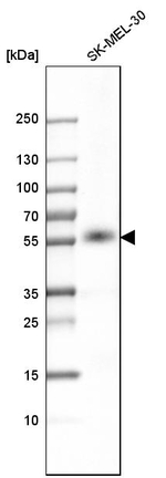 P2X4 Antibody in Western Blot (WB)