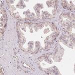 BLMH Antibody in Immunohistochemistry (Paraffin) (IHC (P))