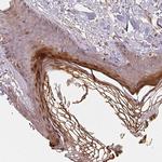 BLMH Antibody in Immunohistochemistry (Paraffin) (IHC (P))