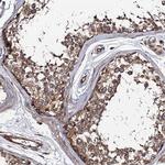 KIAA1524 Antibody in Immunohistochemistry (Paraffin) (IHC (P))