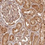 TRAPPC4 Antibody in Immunohistochemistry (Paraffin) (IHC (P))