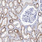 RAB3IP Antibody in Immunohistochemistry (Paraffin) (IHC (P))