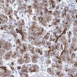 RAB3IP Antibody in Immunohistochemistry (Paraffin) (IHC (P))
