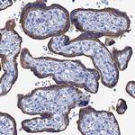 RAB3IP Antibody in Immunohistochemistry (Paraffin) (IHC (P))