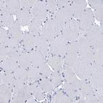 RAB3IP Antibody in Immunohistochemistry (Paraffin) (IHC (P))