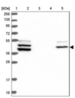 RAB3IP Antibody in Western Blot (WB)