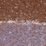 CD56 Antibody in Immunohistochemistry (Paraffin) (IHC (P))