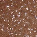 CD56 Antibody in Immunohistochemistry (Paraffin) (IHC (P))