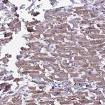 CD56 Antibody in Immunohistochemistry (Paraffin) (IHC (P))