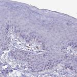 CD56 Antibody in Immunohistochemistry (Paraffin) (IHC (P))