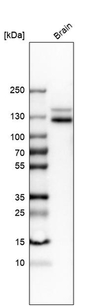 CD56 Antibody in Western Blot (WB)