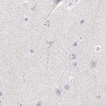 TXNDC6 Antibody in Immunohistochemistry (Paraffin) (IHC (P))