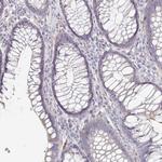 TXNDC6 Antibody in Immunohistochemistry (Paraffin) (IHC (P))