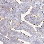 TXNDC6 Antibody in Immunohistochemistry (Paraffin) (IHC (P))