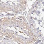 TXNDC6 Antibody in Immunohistochemistry (Paraffin) (IHC (P))