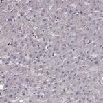 RHAMM Antibody in Immunohistochemistry (Paraffin) (IHC (P))