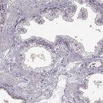RHAMM Antibody in Immunohistochemistry (Paraffin) (IHC (P))