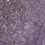 RHAMM Antibody in Immunohistochemistry (Paraffin) (IHC (P))