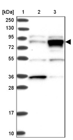 RHAMM Antibody in Western Blot (WB)