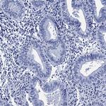 MYBPC3 Antibody in Immunohistochemistry (Paraffin) (IHC (P))