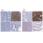 MYBPC3 Polyclonal Antibody