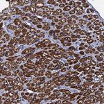 MYBPC3 Antibody in Immunohistochemistry (Paraffin) (IHC (P))