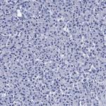 MYBPC3 Antibody in Immunohistochemistry (Paraffin) (IHC (P))