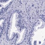 MYBPC3 Antibody in Immunohistochemistry (Paraffin) (IHC (P))