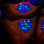 PES1 Polyclonal Antibody