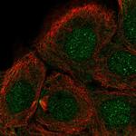DNHD1 Polyclonal Antibody