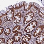 YBX1 Antibody in Immunohistochemistry (Paraffin) (IHC (P))