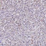 YBX1 Antibody in Immunohistochemistry (Paraffin) (IHC (P))