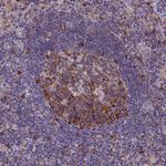 YBX1 Antibody in Immunohistochemistry (Paraffin) (IHC (P))