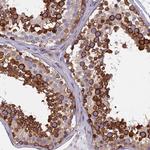 YBX1 Antibody in Immunohistochemistry (Paraffin) (IHC (P))
