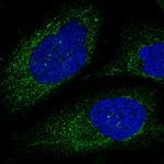Calpain 6 Polyclonal Antibody