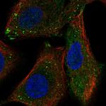 RASSF10 Polyclonal Antibody