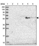 ST3GAL5 Antibody in Western Blot (WB)
