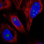 WDR82 Polyclonal Antibody