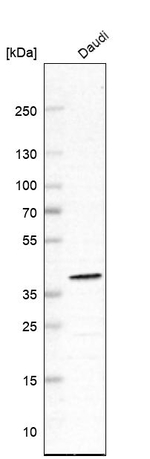 WDR82 Antibody in Western Blot (WB)