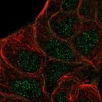 STYK1 Polyclonal Antibody