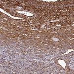 EEF2 Antibody in Immunohistochemistry (Paraffin) (IHC (P))