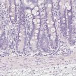 MUC5AC Antibody in Immunohistochemistry (Paraffin) (IHC (P))