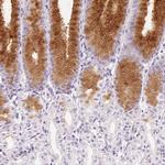 MUC5AC Polyclonal Antibody