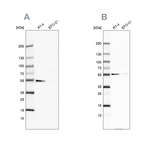 ATP5A1 Antibody in Western Blot (WB)