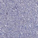 Bcl-G Antibody in Immunohistochemistry (Paraffin) (IHC (P))