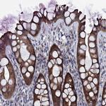 Bcl-G Antibody in Immunohistochemistry (Paraffin) (IHC (P))