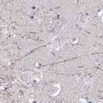 DCLK3 Polyclonal Antibody